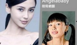 长沙整容爆料案件最新,揭开医美行业潜规则与维权困境