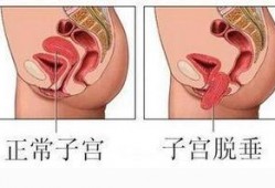 子宫在线观看,在线探索女性生殖奥秘之旅